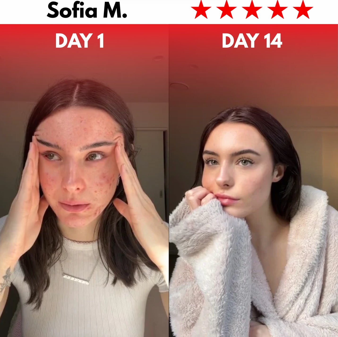 Rejuvify Facial Massager