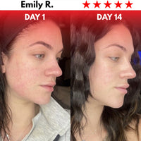 Rejuvify Facial Massager