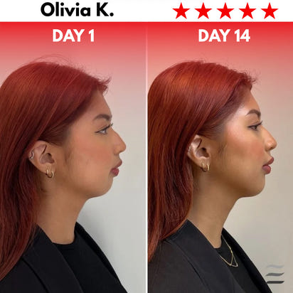 Rejuvify Facial Massager