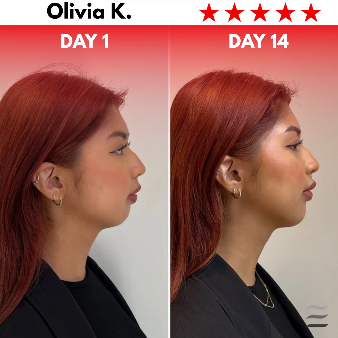 Rejuvify Facial Massager